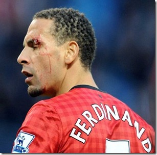 Ferdinand Injury